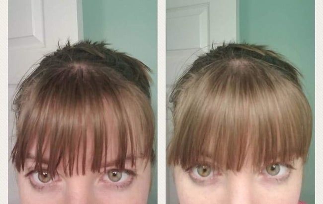 A reviewer’s before and after photos showing how the powder transformed their greasy bangs into freshly washed-looking hair.