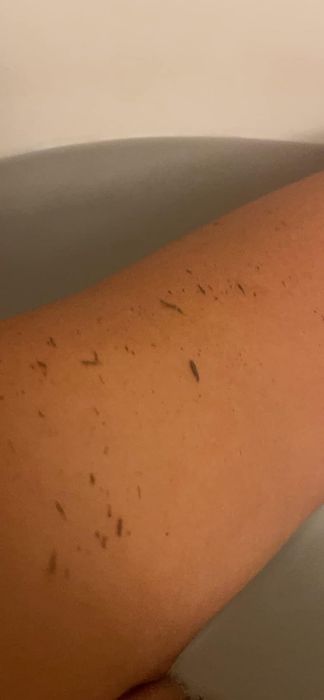 A reviewer's leg with visible dead skin.