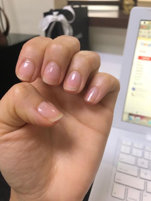 A different reviewer’s before photo of short nails