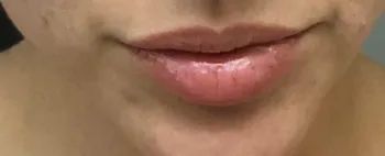 The reviewer's lips before applying the lip plumper