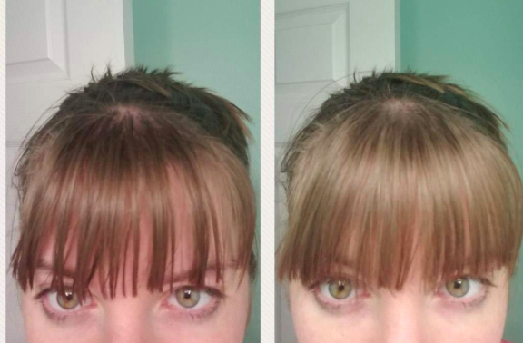 Reviewer showing before-and-after images with noticeably less greasy bangs after using dry shampoo