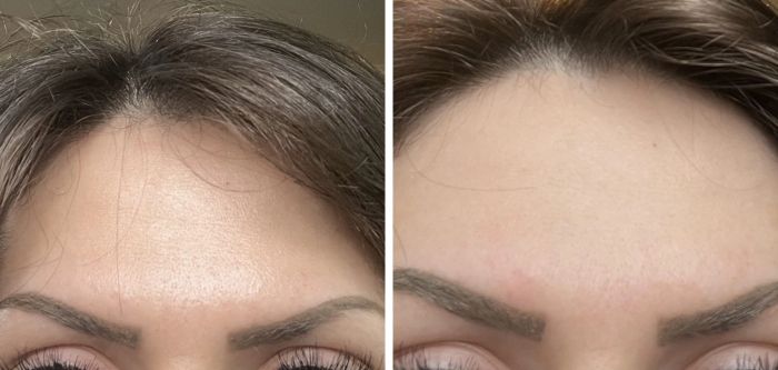 Reviewer's oily forehead before applying the powder