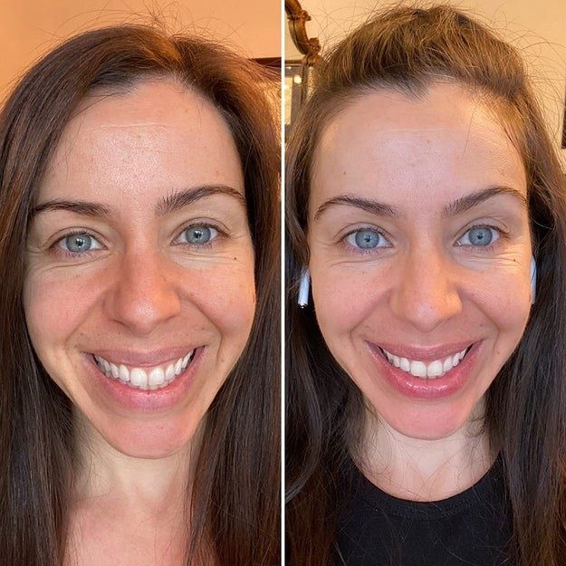 Reviewer showing the effects of using L'Oréal's hyaluronic acid serum