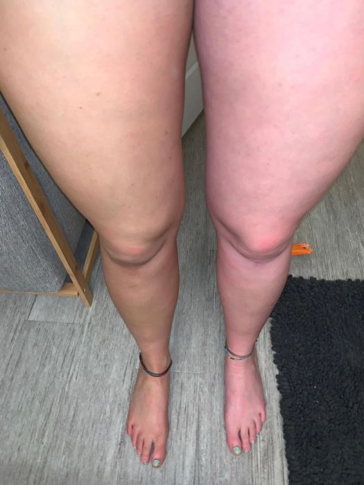Reviewer with self-tanner on one leg and the other leg without.