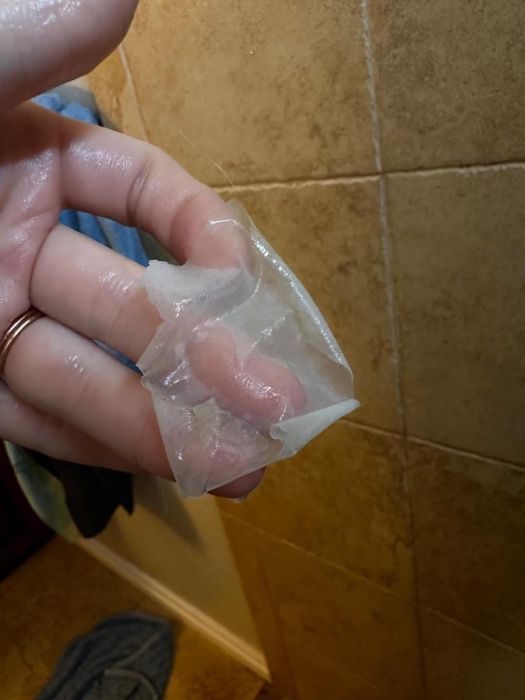 Reviewer holding peeled skin from their foot after using the foot mask