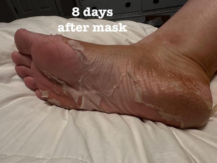 Reviewer's foot after using the foot mask