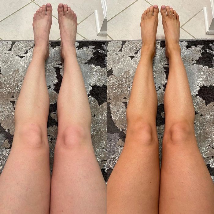 Reviewer showing legs before and after applying self-tanner.