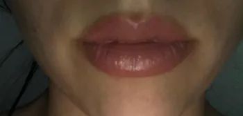 The same reviewer's lips, noticeably fuller after using the lip plumper