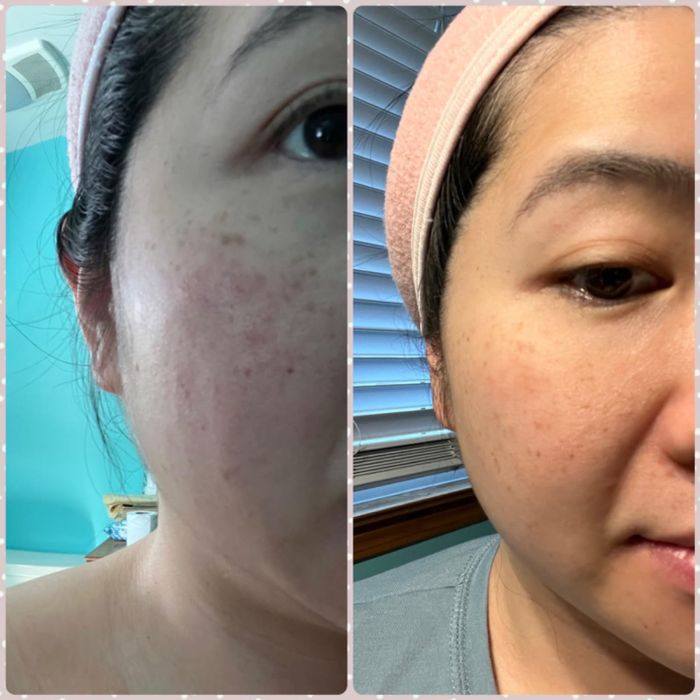 Reviewer showing before and after results of using Eight Saints Up The Anti moisturizer