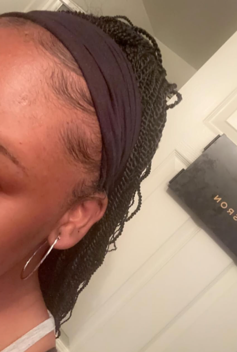 Close-up shot of the reviewer’s baby hairs, perfectly slicked down