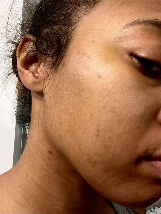 reviewer's skin before applying the essence