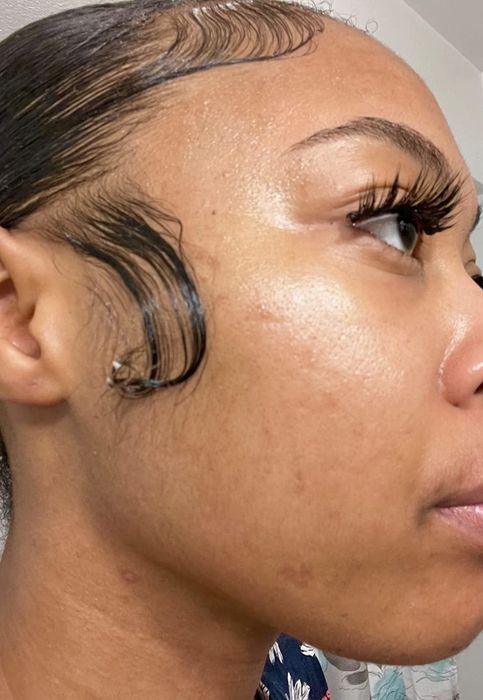 reviewer's skin after using the essence