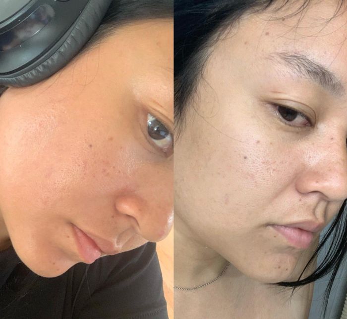 Close-up image showing a reviewer's face with clear improvements in skincare, before and after using the product