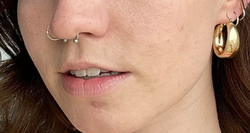 Person after using the exfoliant toner, showing smoother, clearer skin