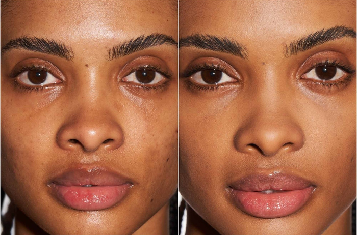 A before-and-after image showing a woman’s face after applying Profilt'r Soft Matte Foundation, showcasing smooth, even skin and a flawless complexion.