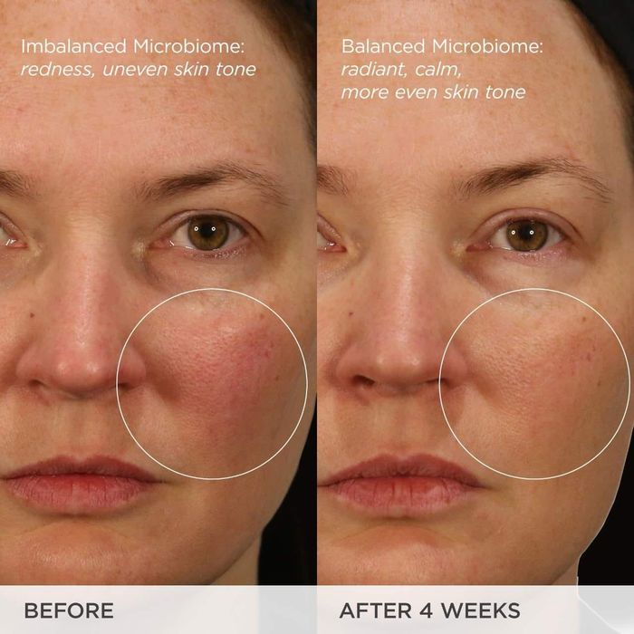 Close-up, side-by-side before-and-after images of a model’s face, taken after using a skincare product for four weeks, revealing noticeable improvements in skin tone and reduced redness