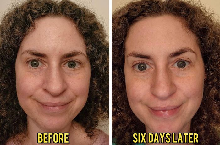 Side-by-side photos of a reviewer showing their face before and six days after using a skincare product. The text reads