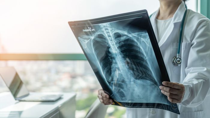 Doctor examining an X-ray image