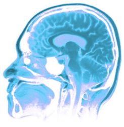 Mri Brain