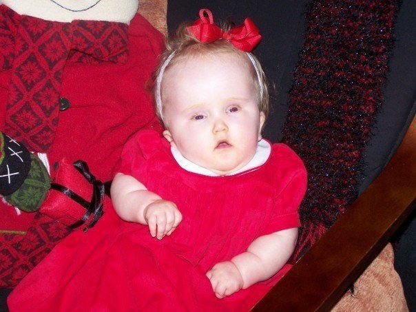 Zoe during Christmas, before our hospital admission