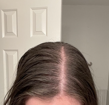 A reviewer’s hair looking greasy before using the dry shampoo