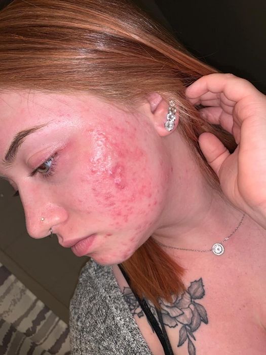 A customer’s photo showing their face before applying the foundation