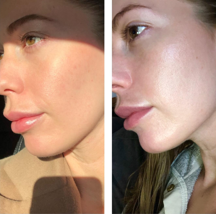 A side-by-side close-up of a reviewer's face highlighting improvements in skin texture and hydration levels
