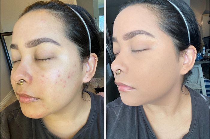 A reviewer's before-and-after photos showing the foundation's transformative effect