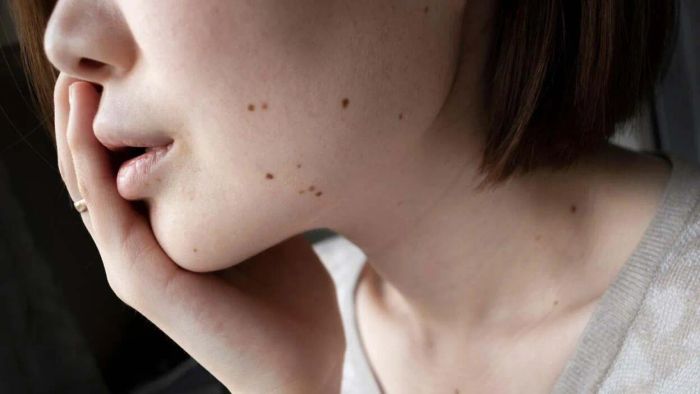 Ways to Overcome Persistent Irritations