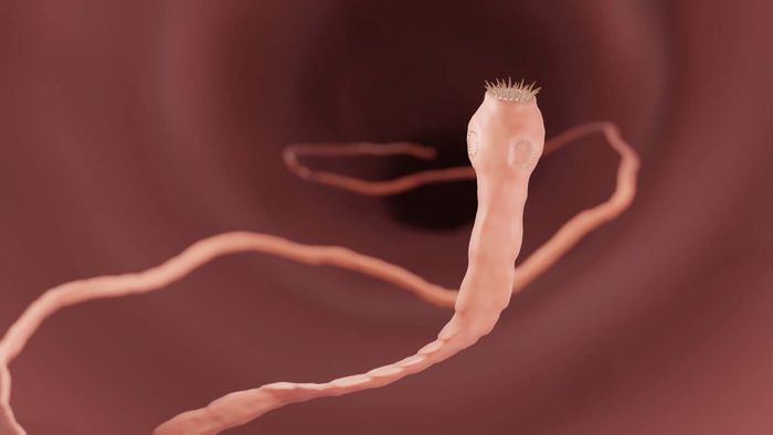 Tapeworms infection