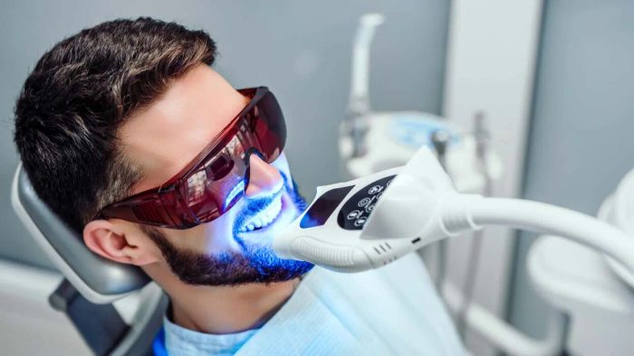 Here’s a look at how effective teeth-whitening products actually work