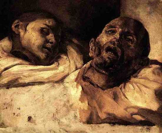Gericault's study of severed heads presents a chilling portrayal of human fragility and mortality. His intense exploration of the body, in its most grotesque form, brings the viewer face to face with the disquieting reality of death.