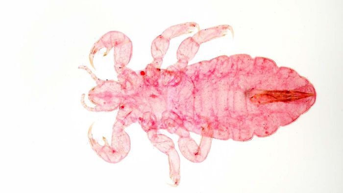 Body lice