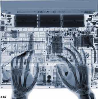 Xray012.Gif