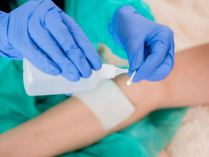 Hydrogen peroxide is an effective solution for cleaning cuts
