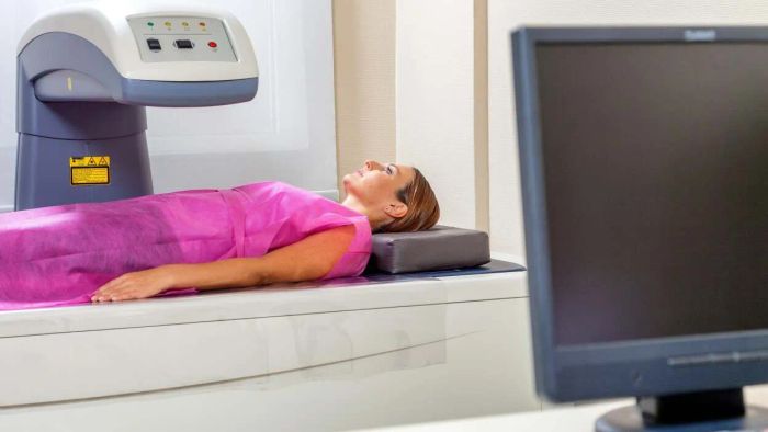 Who Should Consider a Bone Density Test?