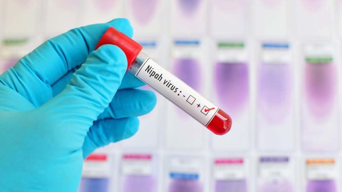 How concerned should you really be about the Nipah Virus?