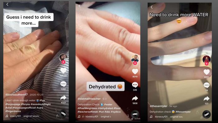 Three images from TikTok showing individuals pinching the skin on their knuckles