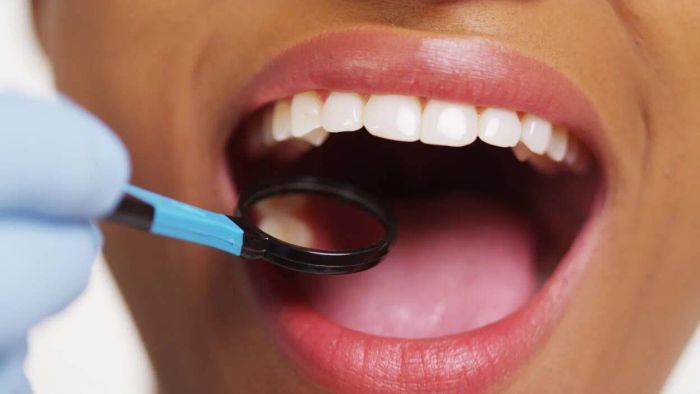 Reversing Cavities: A Guide to Prevention and Treatment