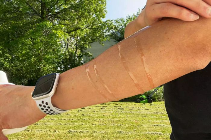 A person applying Sawyer Products Controlled Release Insect Repellent (20% DEET) to their arm