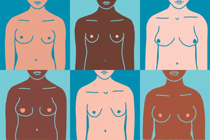 An illustration displaying various breast shapes.