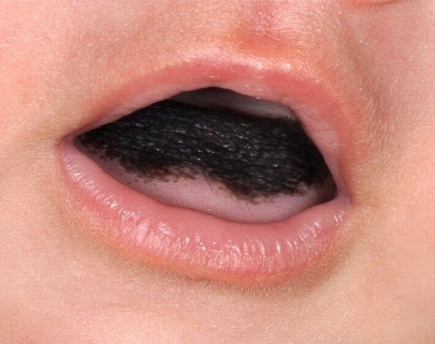 tongue