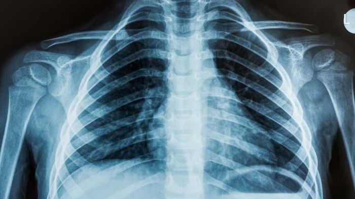 X-rays and other medical images are meant to remain confidential, as part of your medical records. However, a recent investigation by ProPublica uncovered that patients' images were freely available online for anyone to view.