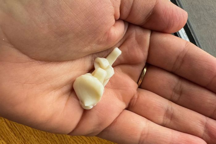 A close-up view of a dollop of Gold Bond Age Renew Retinol Overnight Body and Face Lotion in someone’s hand