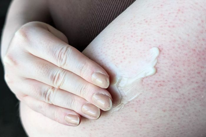 An individual applying Nécessaire The Body Retinol