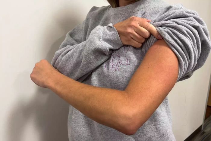 An arm showing the effects after applying Replenix Retinol Smooth + Tighten Body Lotion