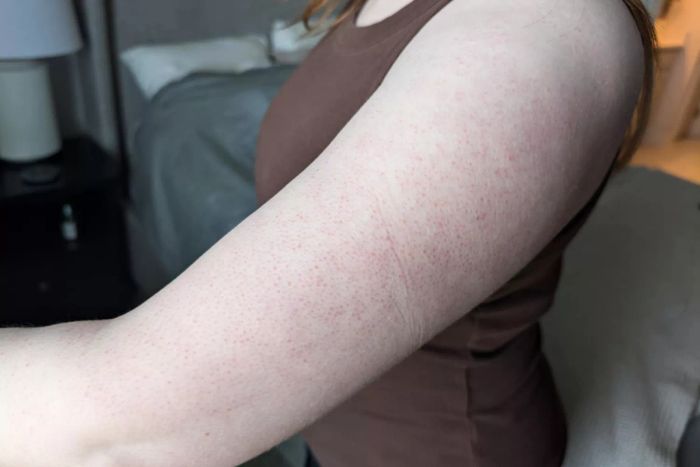 A person’s arm before the application of Nécessaire The Body Retinol