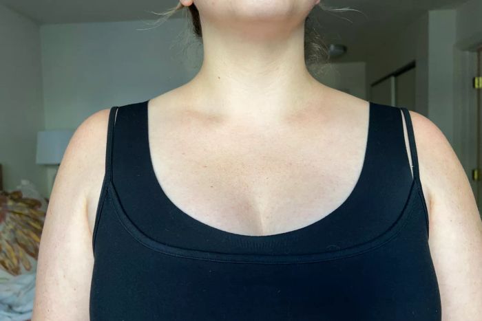 A person’s neck and chest area before the application of Soft Services Software Update Retinol Body Serum