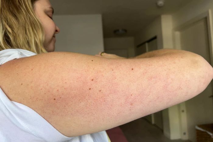 An arm showing the effects after applying Soft Services Software Update Retinol Body Serum