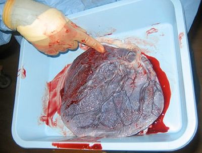 350Px-Human Placenta Baby Side